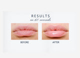 LIPSMART Lip Treatment